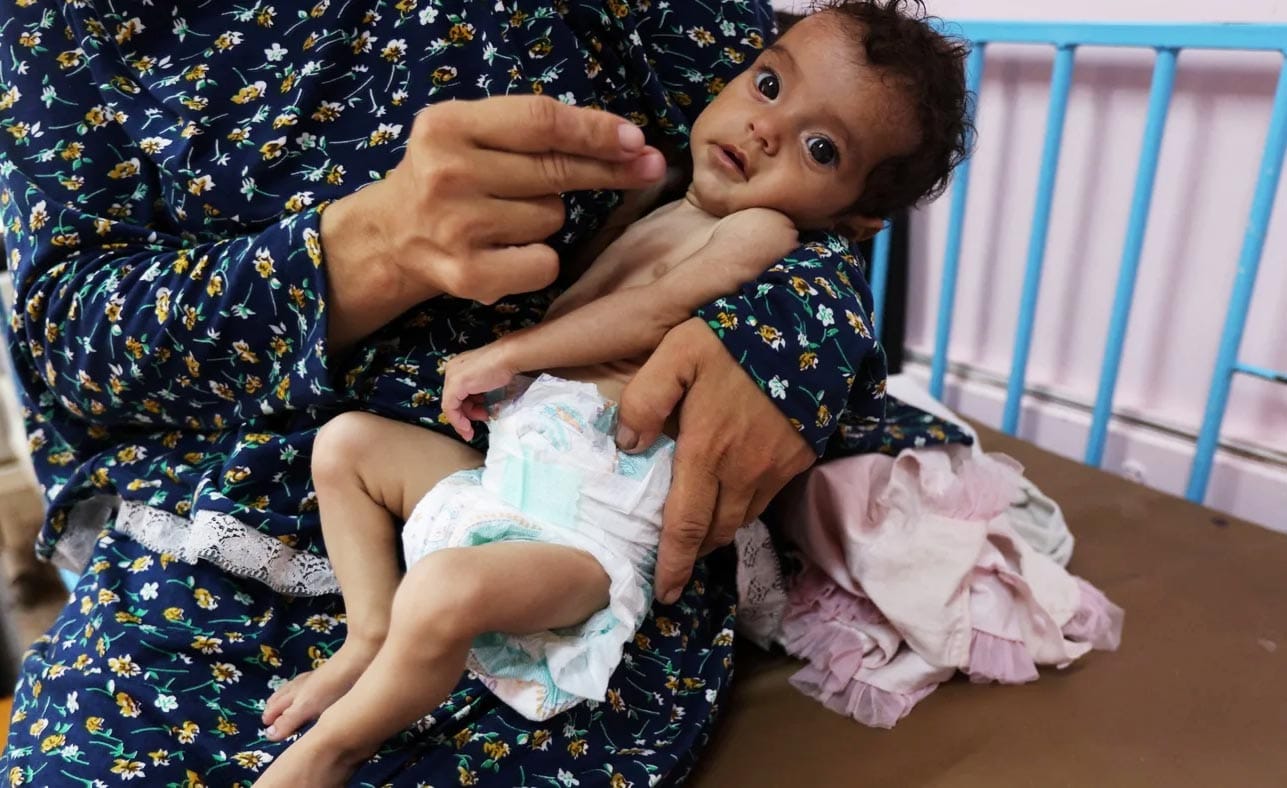 غزہ میں فاقہ کشی سے اموات، عالمی برادری کی خاموشی تشویشناک